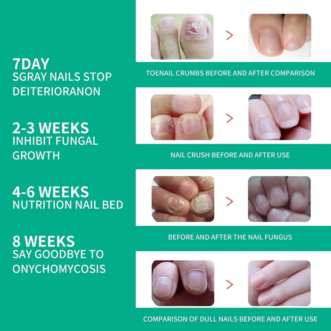 Nail Fungus Treatments Serum healthy growth of nails for fungus
