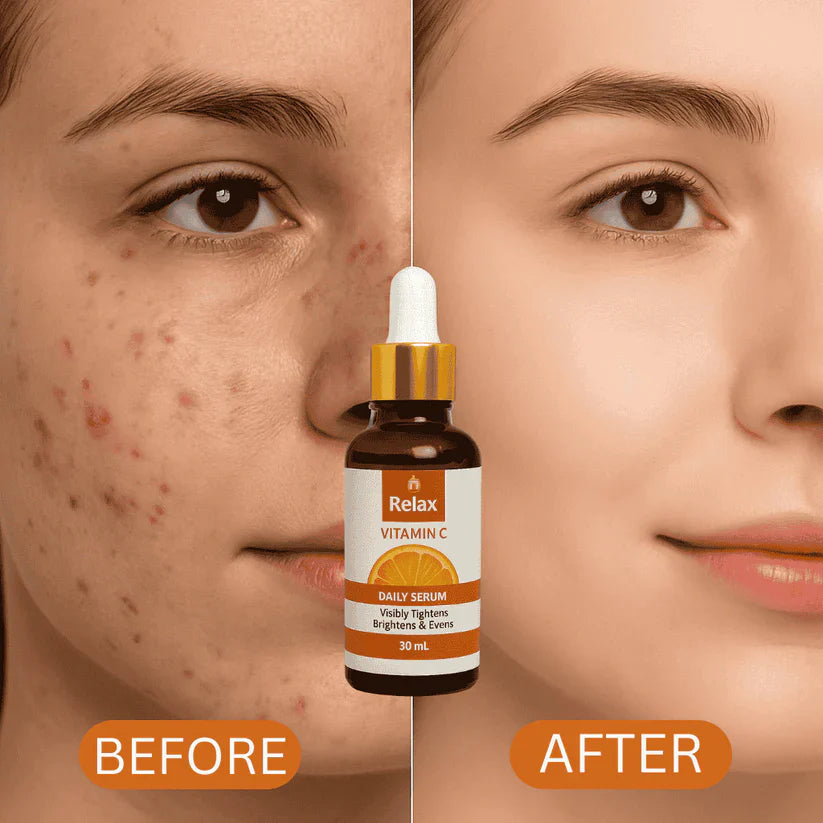 ORGANIC LAB | FACE SERUM 30ML (VITAMIN C)