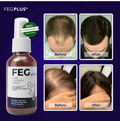 MOST VIRAL FEG PLUS HAIR GROWTH SPRAY