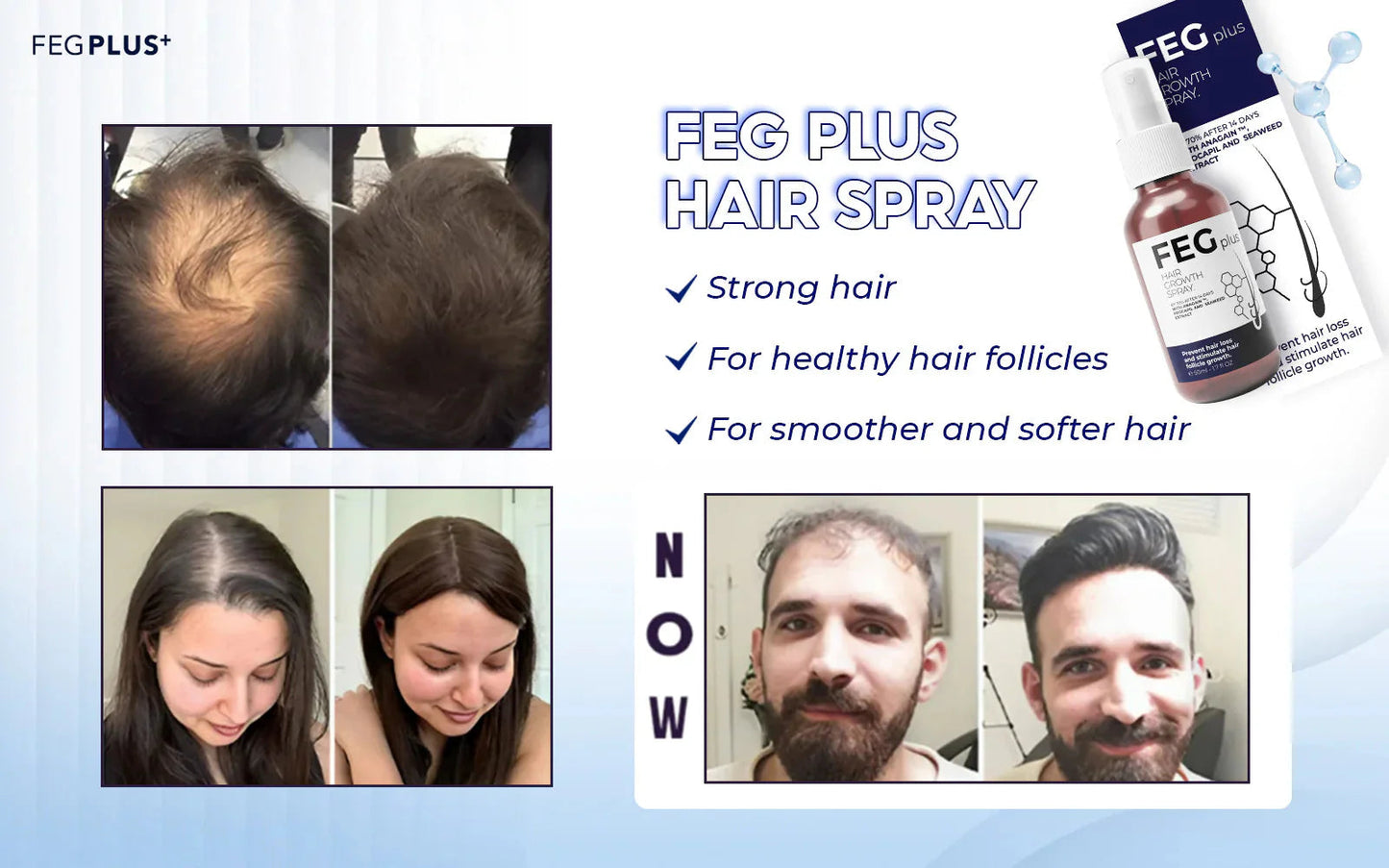 MOST VIRAL FEG PLUS HAIR GROWTH SPRAY
