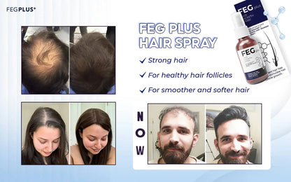 MOST VIRAL FEG PLUS HAIR GROWTH SPRAY